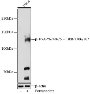 Western Blot: TrkA/B [p Tyr707, p Tyr675, p Tyr706, p Tyr674] Antibody [NBP3-16897] - Western blot analysis of extracts of HeLa cells, using TrkA/B antibody (NBP3-16897) at 1:500 dilution.HeLa cells were treated by Pervanadate (1 nM) at 37C for 30 minutes after serum-starvation overnight. Secondary antibody: HRP Goat Anti-Rabbit IgG (H+L) at 1:10000 dilution. Lysates/proteins: 25ug per lane. Blocking buffer: 3% nonfat dry milk in TBST. Detection: ECL Basic Kit. Exposure time: 30s.